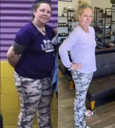 Nicole-before-and-after